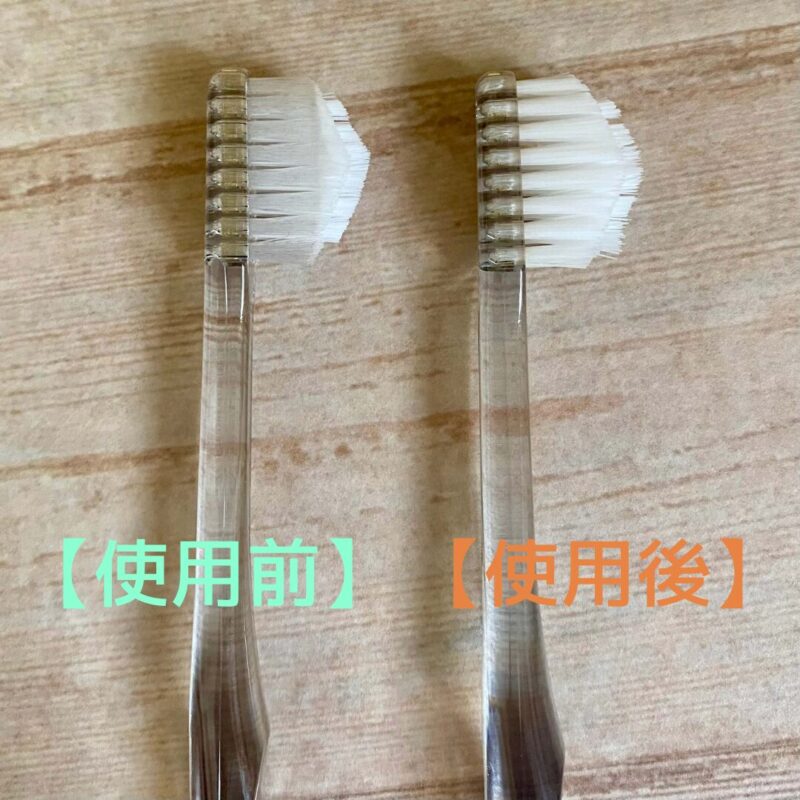 奇跡の歯ブラシの使用前と使用後の比較画像